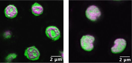 Super-resolution image of a nucleolus in a live, wild-type C. elegans nematode. 